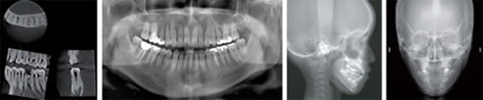 歯科用CT装置